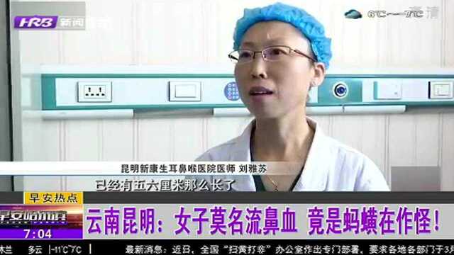 云南昆明:女子莫名流鼻血 竟是蚂蟥在作怪!