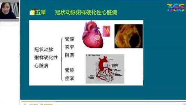 心血管系统:冠状动脉粥样硬化性心脏病之心绞痛常见病理反应