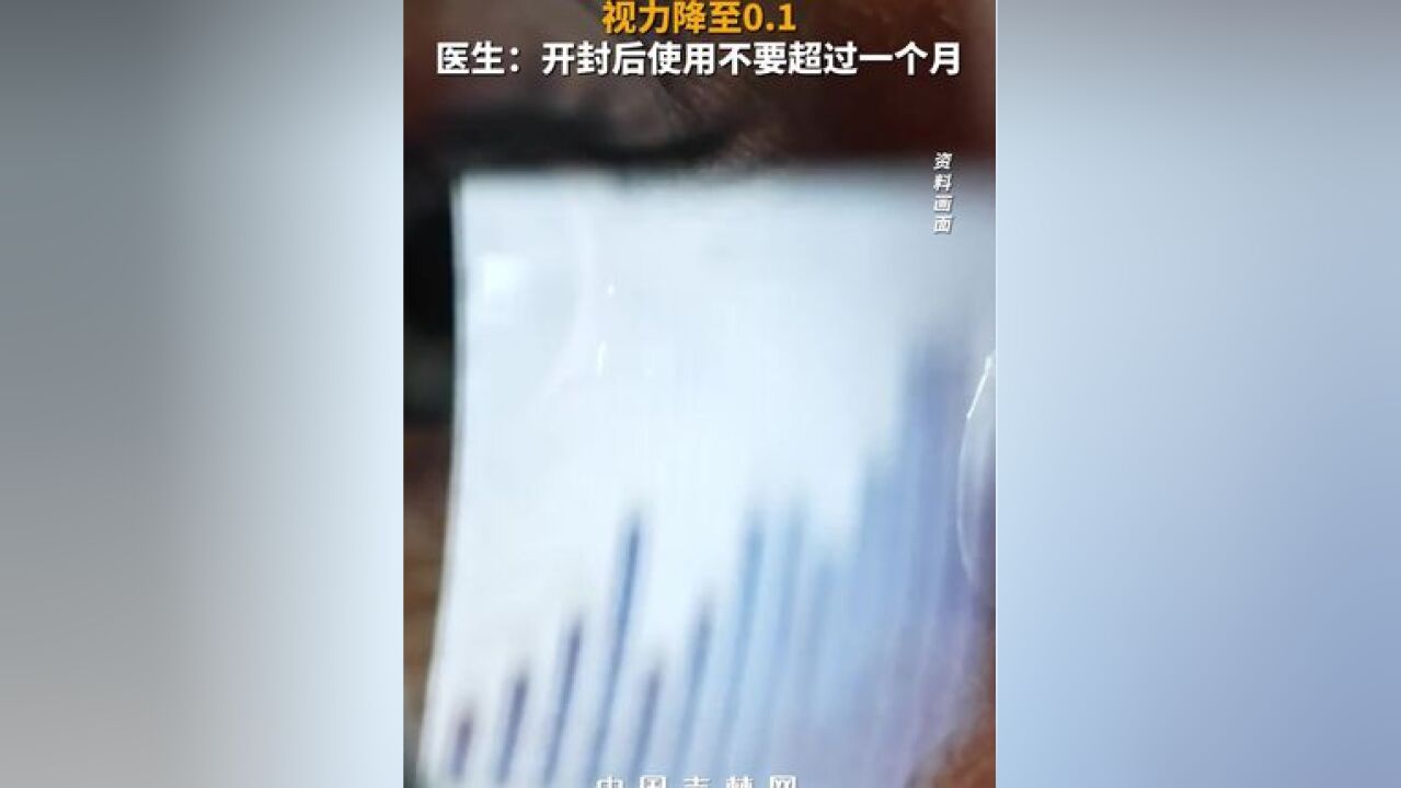 女子用过期眼药水视力降至0.1,医生:开封后使用不要超过一个月