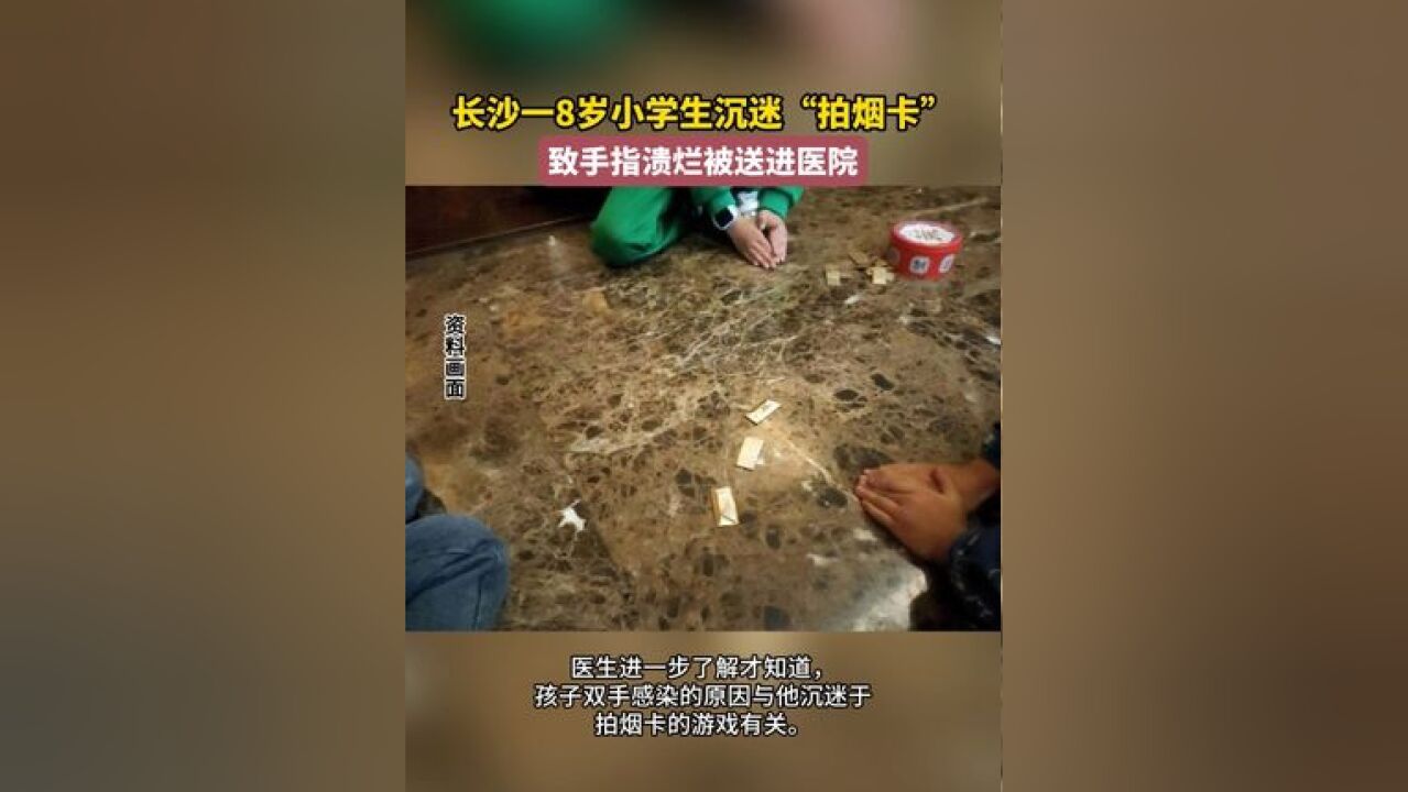 长沙一8岁小学生沉迷“拍烟卡”,致手指溃烂