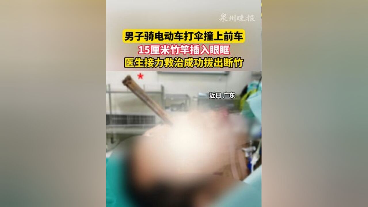 男子骑电动车打伞撞上前车,15厘米竹竿插入眼眶,医生接力救治成功拔出断竹.#广州