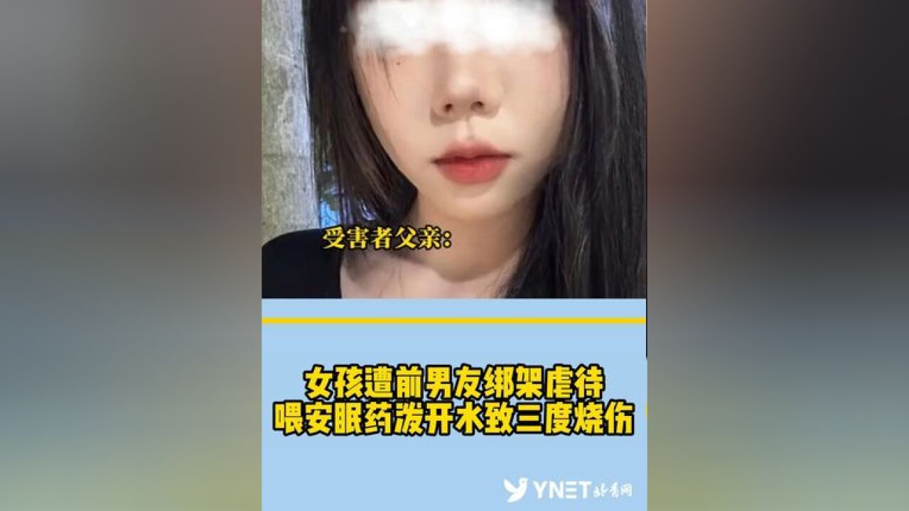 女孩遭前男友绑架虐待 喂安眠药泼开水致三度烧伤 知情者:男子以为女孩已经死了才跑去自首