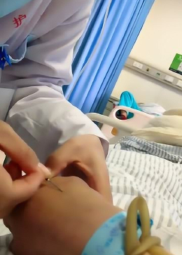 护士小姐姐竟然扎针失败了，真是尴尬，不过没关系，再来一次吧 - 腾讯视频