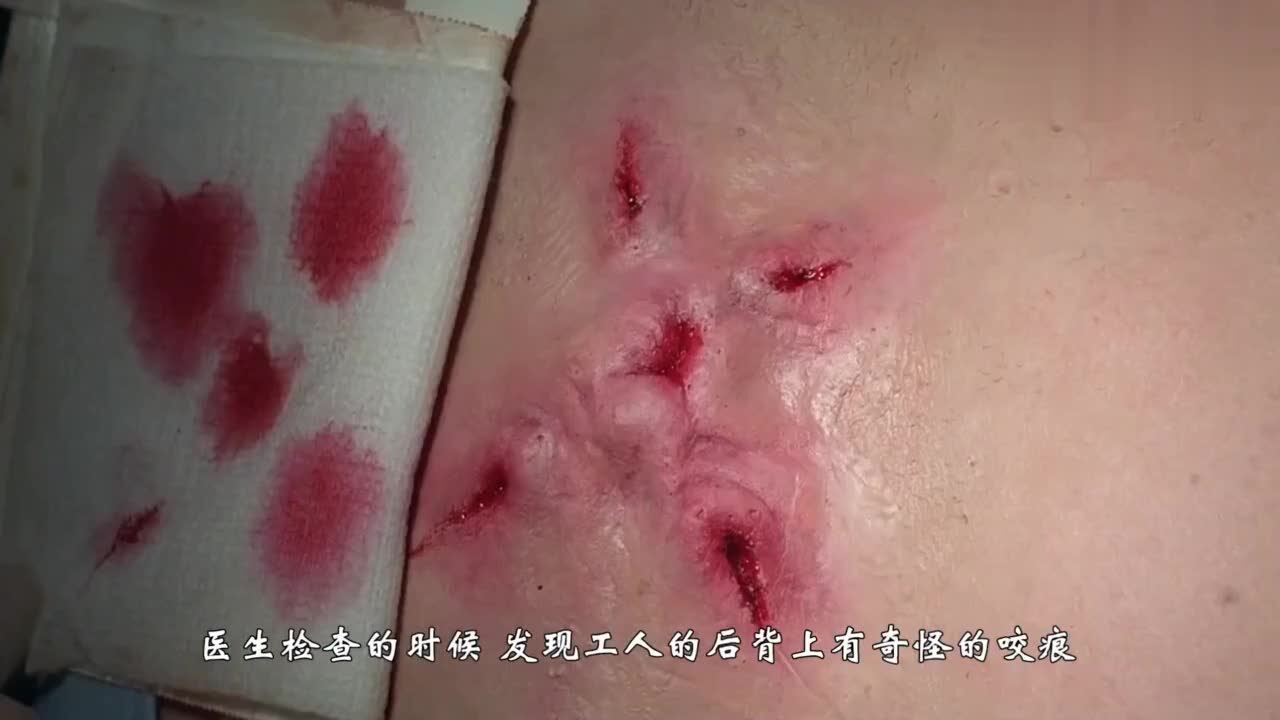 x档案下水道里出现了怪物人被咬伤身体里长出了虫子