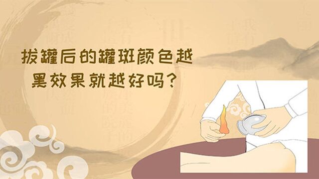 【健康解码】文碧玲:拔罐后的罐斑颜色越黑效果就越好吗?