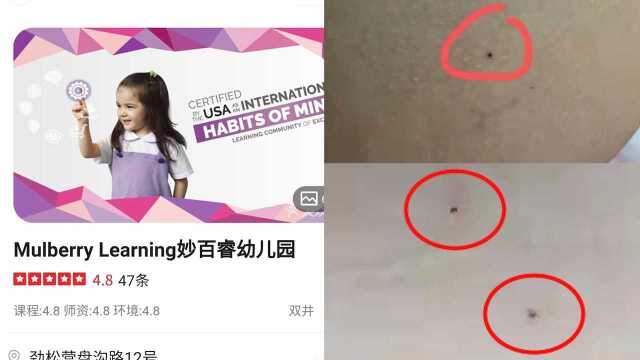 网传北京一幼儿园老师针扎孩子 教委:警方正调查,幼儿园正常运行