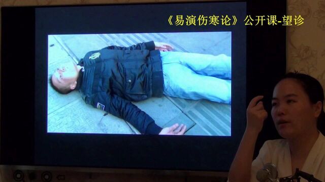 中医望诊痉证易演伤寒论公开课