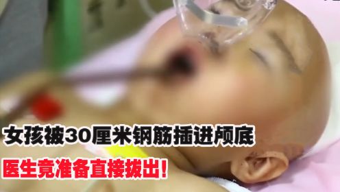 北京三岁女童被钢筋插进大脑，医生看后无从下手，竟要整根拔出？
