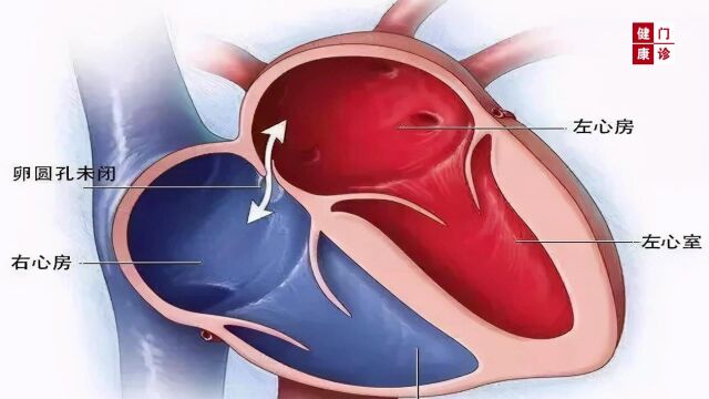 隐藏的杀手——邯郸市第一医院心内一科主任 赵秀峰