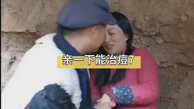 男人的嘴能治痘8 #乡村爱情故事