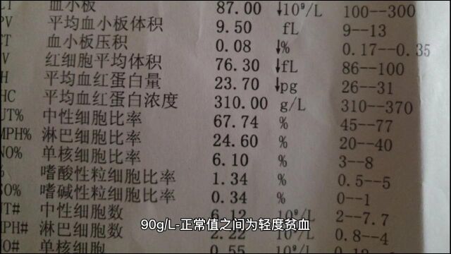 教你如何看懂血常规的化验单