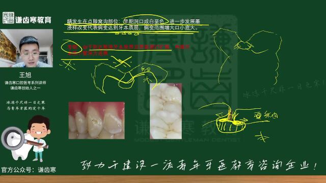 2023年口腔执业(含助理)医师资格考试——牙体牙髓病学