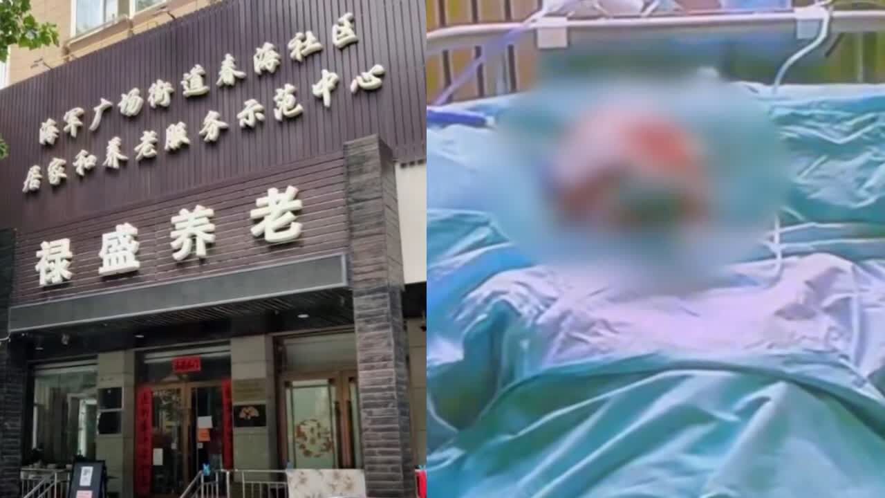 男子曝73岁父亲被养老院护工打爆眼球,民政部门:正确认是否为个例