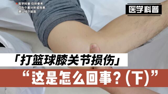 打篮球膝关节损伤,这是怎么回事?看肖医生真实案例讲解(下)