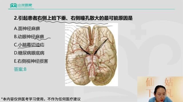 2023年医家医考最新临床课程 孙荣老师主讲小视频——动眼神经麻痹