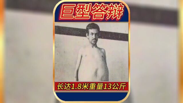 世界上最长的屎竟然有1.8米长#真实事件