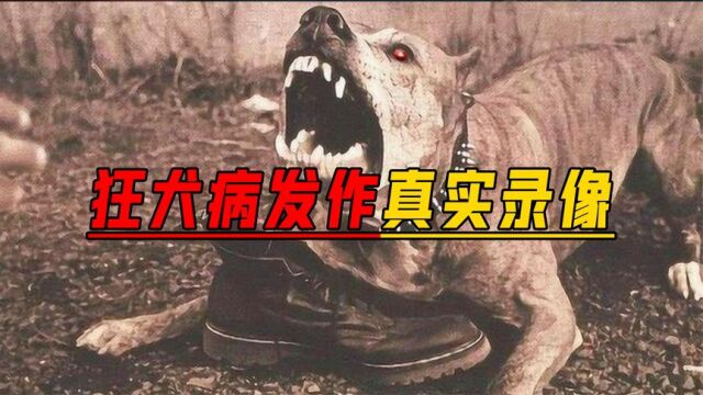 狂犬病为啥那么恐怖?人类与狂犬病的斗争史,2004年有人被治愈!