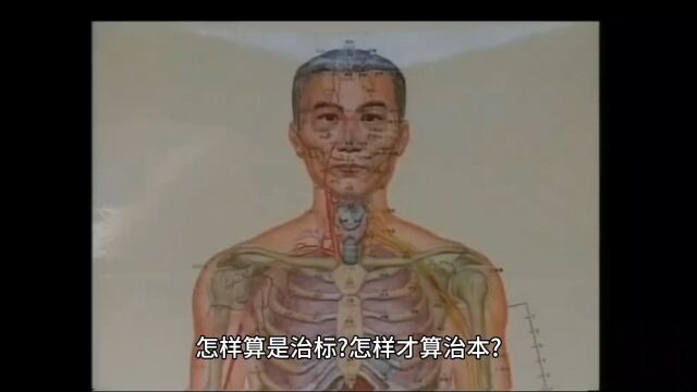 怎样才算治标,怎样才算治本?