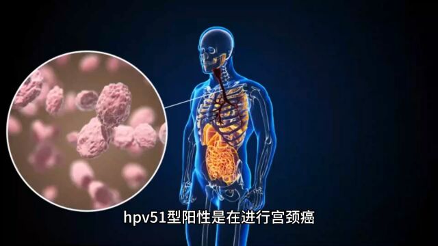 hpv51型阳性是什么意思南京家和医院