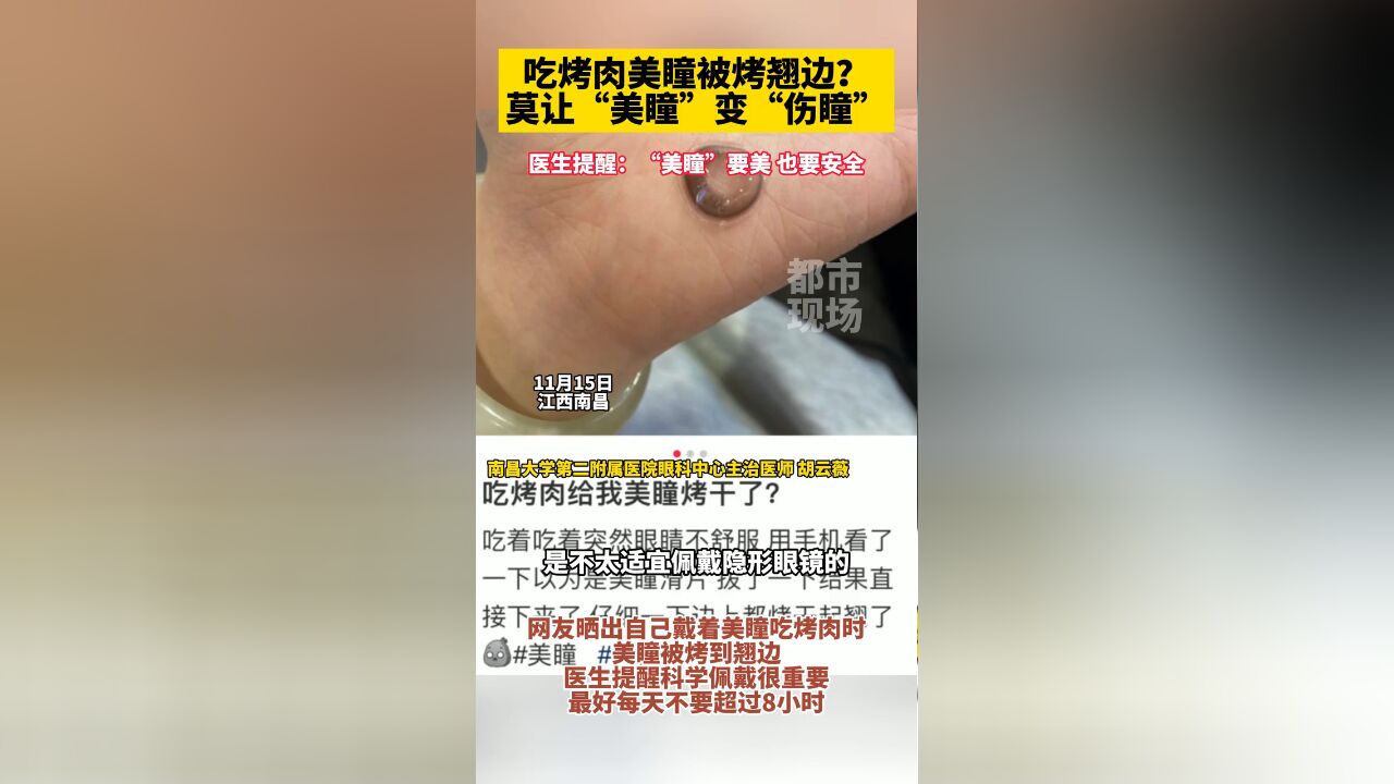 女子吃烤肉美瞳被烤翘边?医生提醒莫让“美瞳”变“伤瞳”