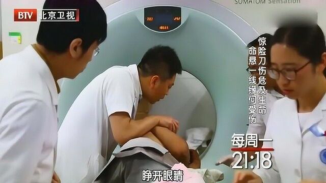 男子身中刀伤意识模糊,检查后事态很严重,超乎医生的想象