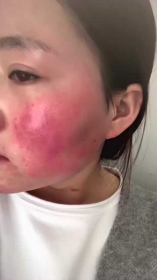 Thumbplayer Poster Plugin Image