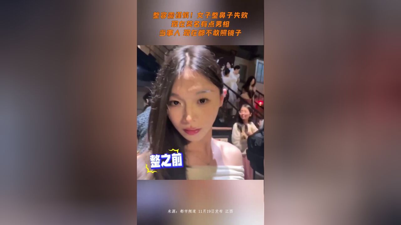 整容需谨慎!女子整鼻子失败,现在莫名有点男相