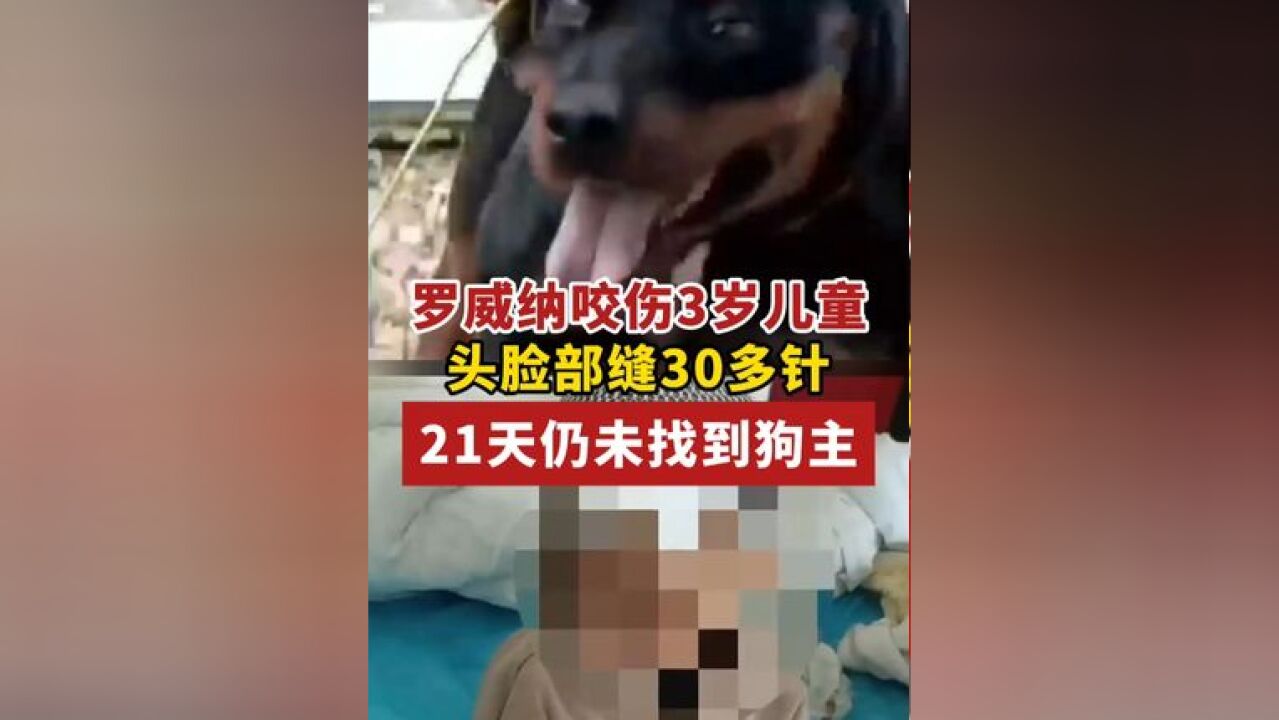 河南信阳,一只未拴绳的罗威纳犬咬伤一名三岁孩童,事发21天未找到狗主人