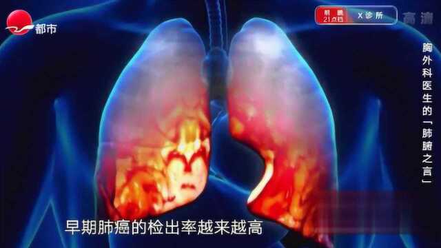 CT,胸片有什么区别?哪个检查对肺癌筛查有利?看完你就明白了!