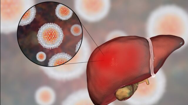 2020诺贝尔医学奖背后:丙肝病毒是如何发现的?