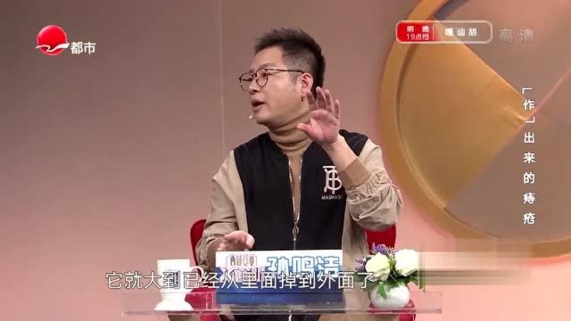 痔疮4个阶段逐步引发大问题,专家详细来讲解,现在知道还不晚