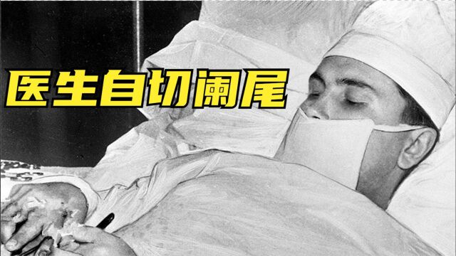 5个对自己下狠手的疯狂科学家,医者不自医?看我表演自切阑尾!