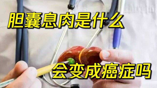 胆囊息肉是什么?会变成癌症吗?医生为您解答!