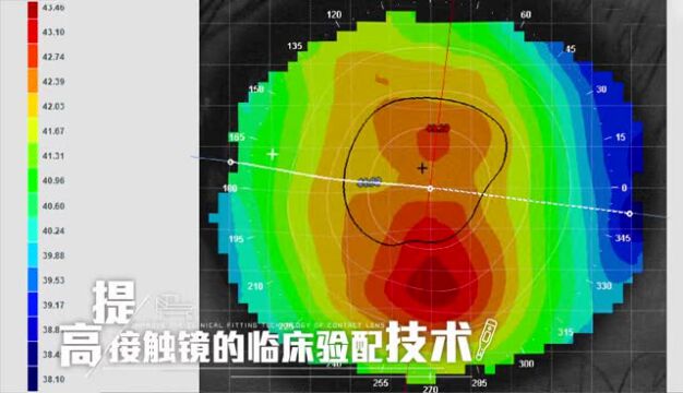 18位眼视光专家联手打造,《接触镜临床验配》在慕课平台正式上线