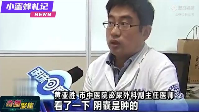 奇葩:小伙网上学习“自宫”大法,亲手把自己的蛋蛋割下来!