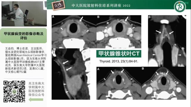 甲状腺肿瘤及肿瘤样病变影像诊断与评估王焱均