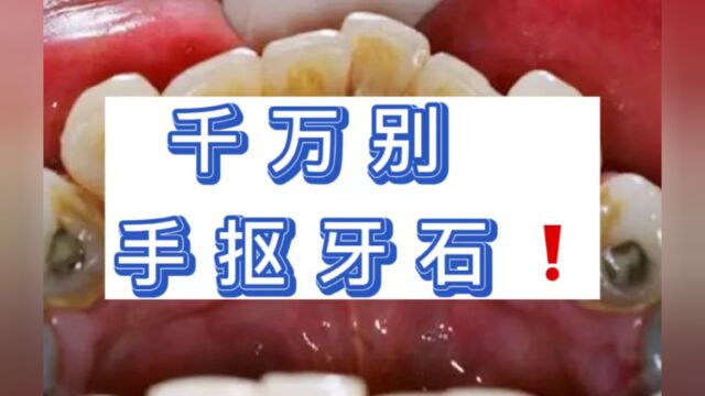 只有你还在用手抠牙结石?在家随便动动牙刷去牙石的方法真的省钱!!