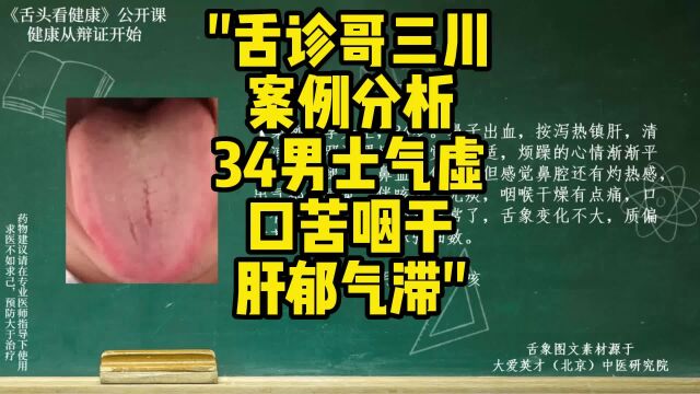 舌诊哥案例分析:34男士,气虚,口苦,咽干,肝郁气滞