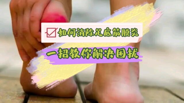 如何消除足底筋膜炎?一招教你解决困扰!