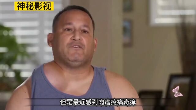 法克鱿肩上长个肉瘤,给他生活带来很大的影响!