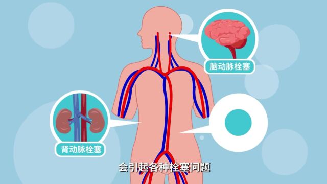 房颤好危险?专家告诉你如何治疗更安全——广州市红十字会医院