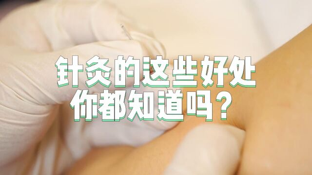 针灸的这些好处,你都知道吗?