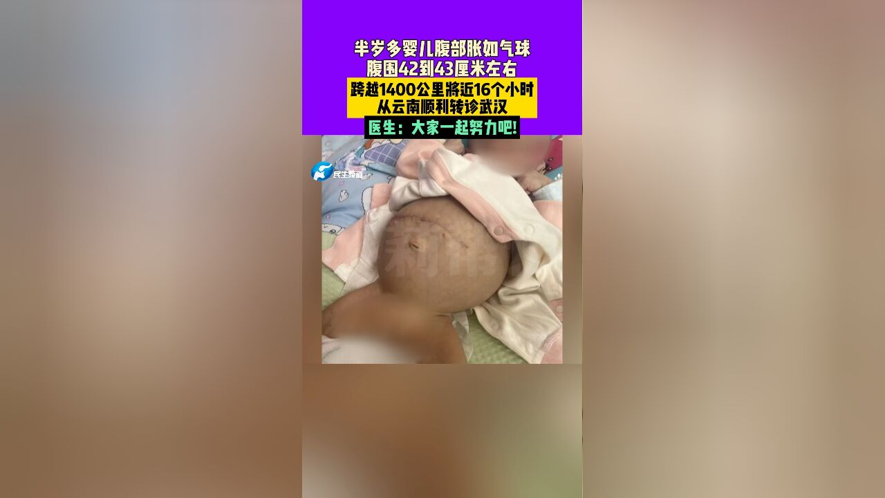 6个月大男婴腹胀如气球,跨越1400公里将近16个小时,云南成功转诊武汉