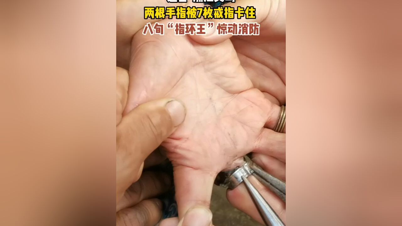 两根手指被7枚戒指卡住,义乌八旬“指环王”惊动消防