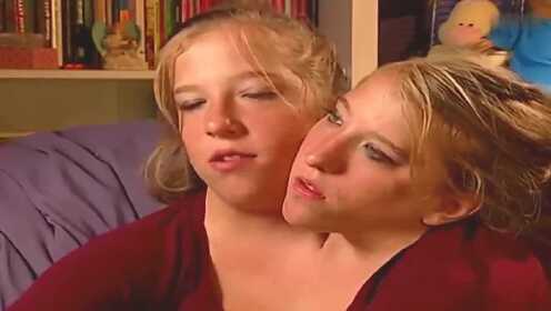 双头姐妹，出生时医生告诉她活不过24小时，结果她们现已长大 - 腾讯视频