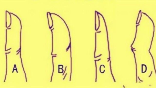 食指的形状,会影响你发财?“享福”还是“奔波”,看看就知道了