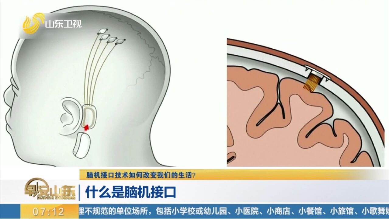 什么是脑机接口,这项技术会如何影响和改变我们的生活?来看看