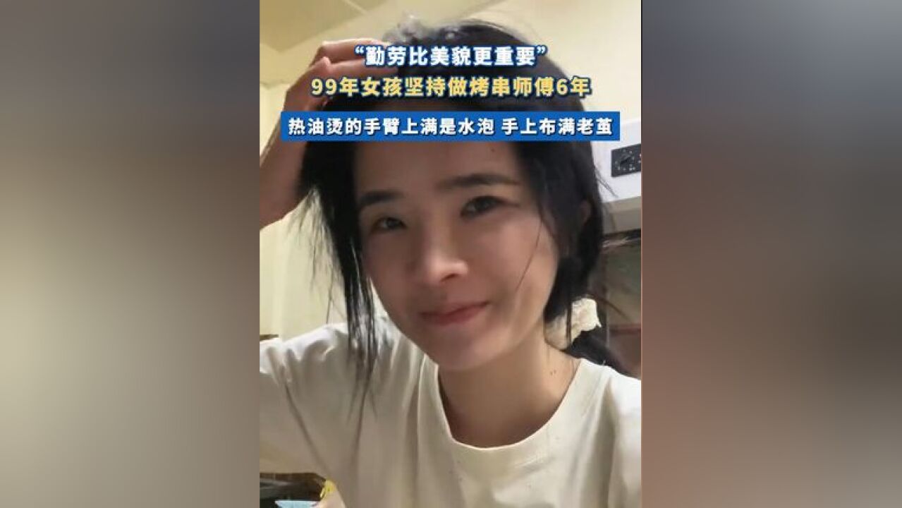 99年女孩坚持做烤串师傅6年 热油烫的手臂上满是水泡