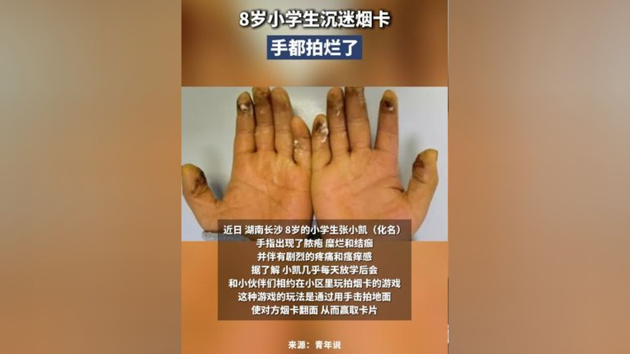 8岁小学生沉迷烟卡手都拍烂了