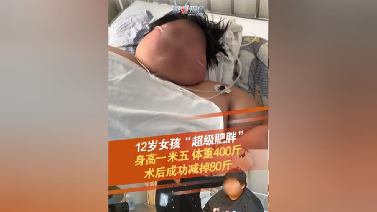 河南开封兰考一名12岁女孩 ,身高1米5 ,体重却达到了400斤,已经无法正常行走,在家中靠呼吸机生活